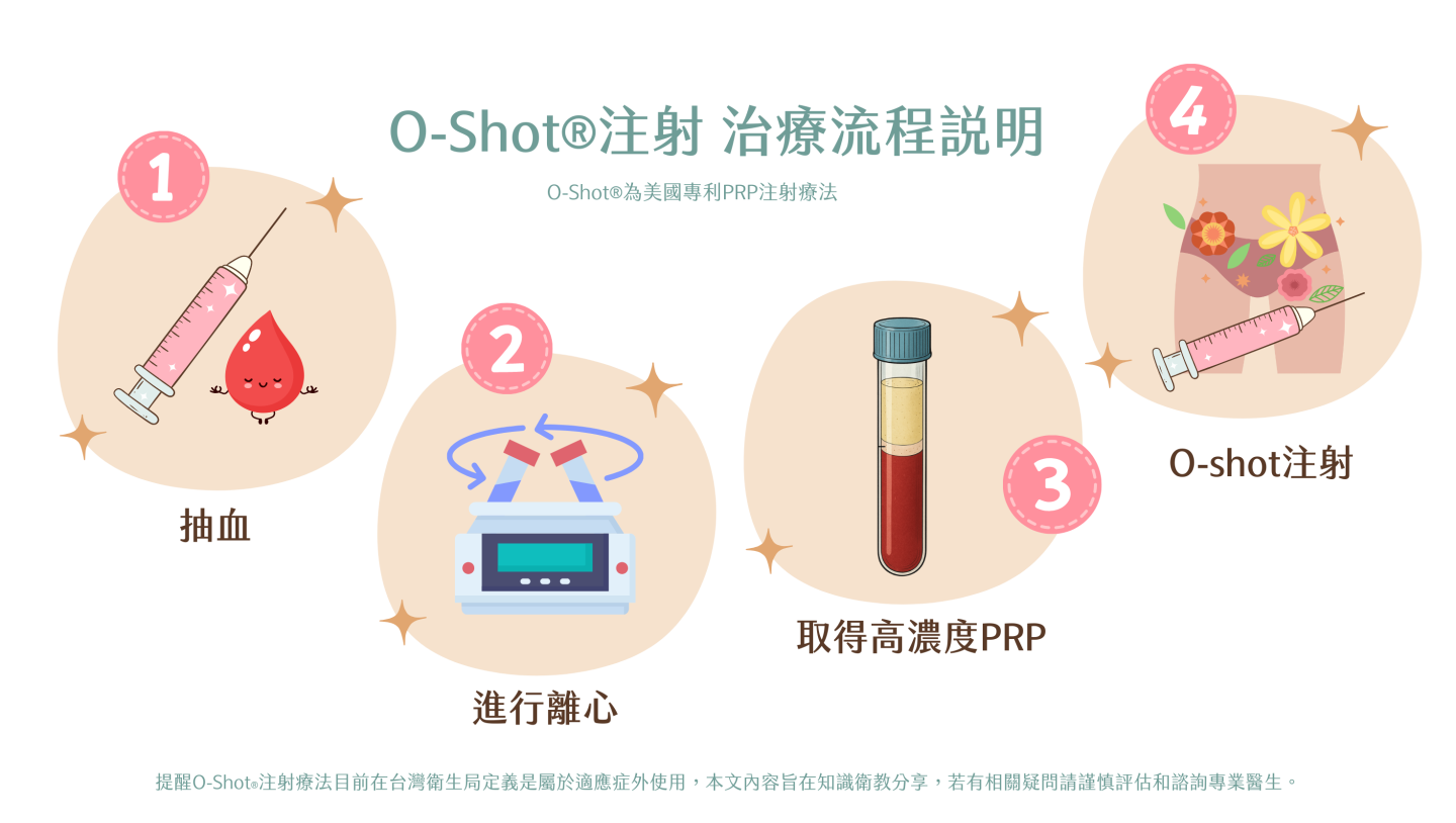 O-Shot(PRP)自體血小板血漿注射療法